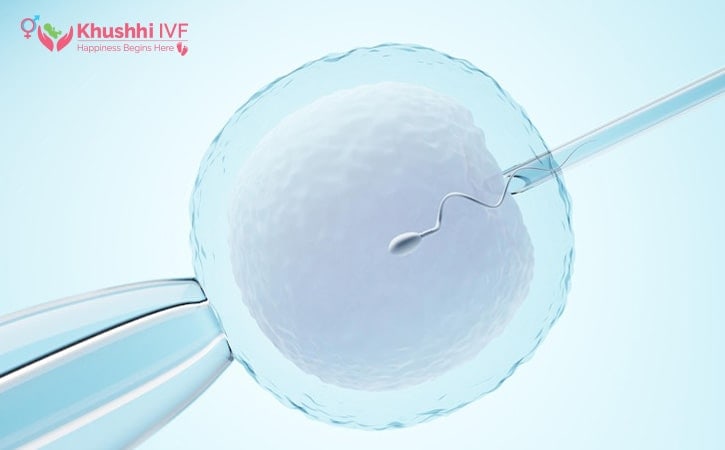 IVF refund Guarantee program